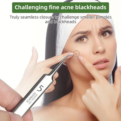 Extra Fine No.5 Acne Tweezers