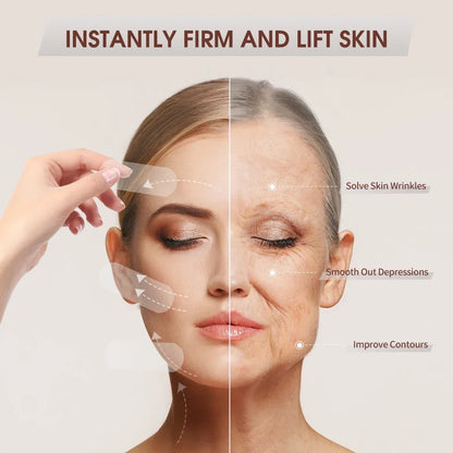 Invisible V-Shape Lifting Patches