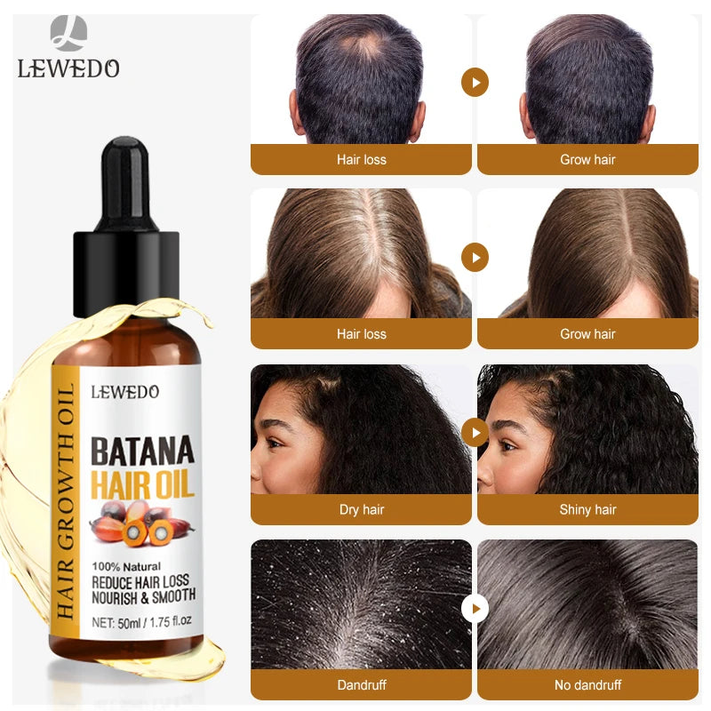 Batana Hair Growth Serum