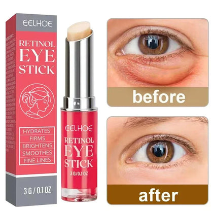 Retinol Eye Cream