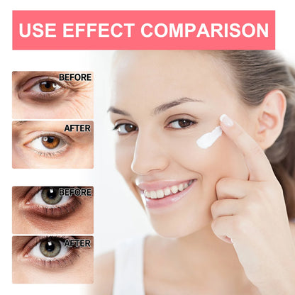 Retinol Eye Cream