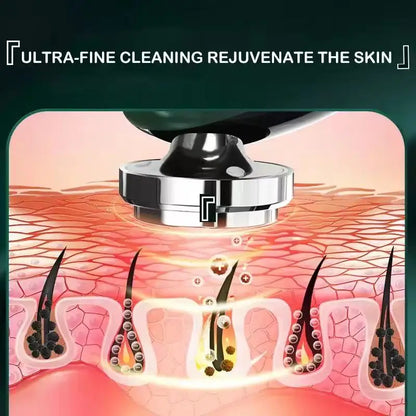 4-in-1 RF Facial Massager