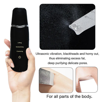 Ultrasonic Deep Face Cleaning Scrubber