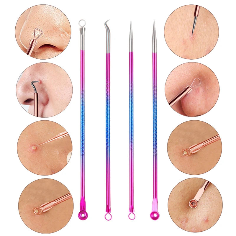 4-Piece Stainless Steel Acne Blackhead and Pimple Remover Set