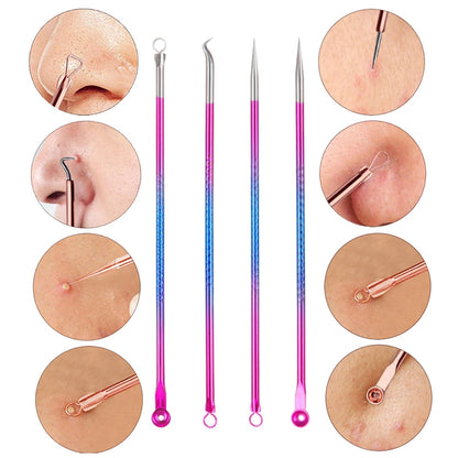 4-Piece Stainless Steel Acne Blackhead and Pimple Remover Set