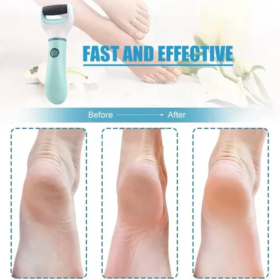 Rechargeable Waterproof Electric Foot Callus Remover Pedicure Kit