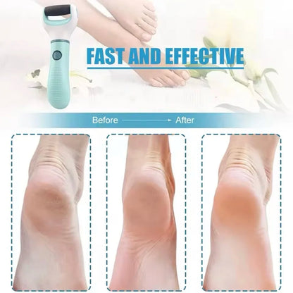 Rechargeable Waterproof Electric Foot Callus Remover Pedicure Kit