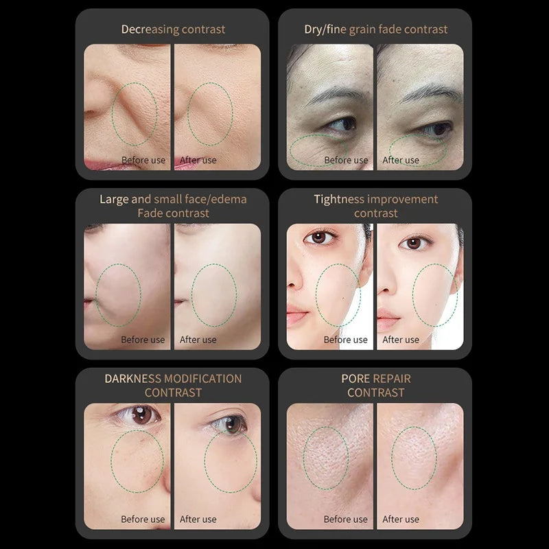 RF EMS Microcurrent Red Light Device
