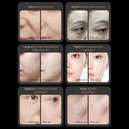 RF EMS Microcurrent Red Light Device