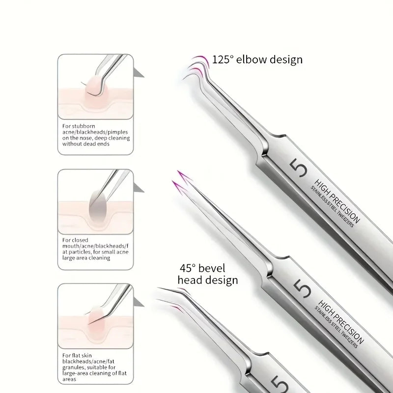 Extra Fine No.5 Acne Tweezers