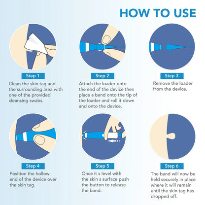 Automatic Skin Tag and Mole Removal Kit