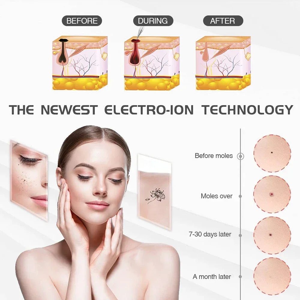 Replacement Needles for Laser Plasma Pen