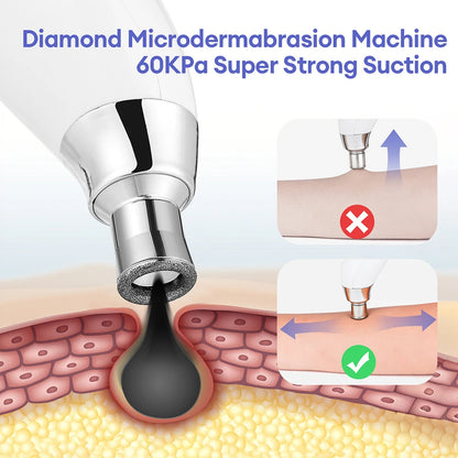 Diamond Microdermabrasion Facial Device