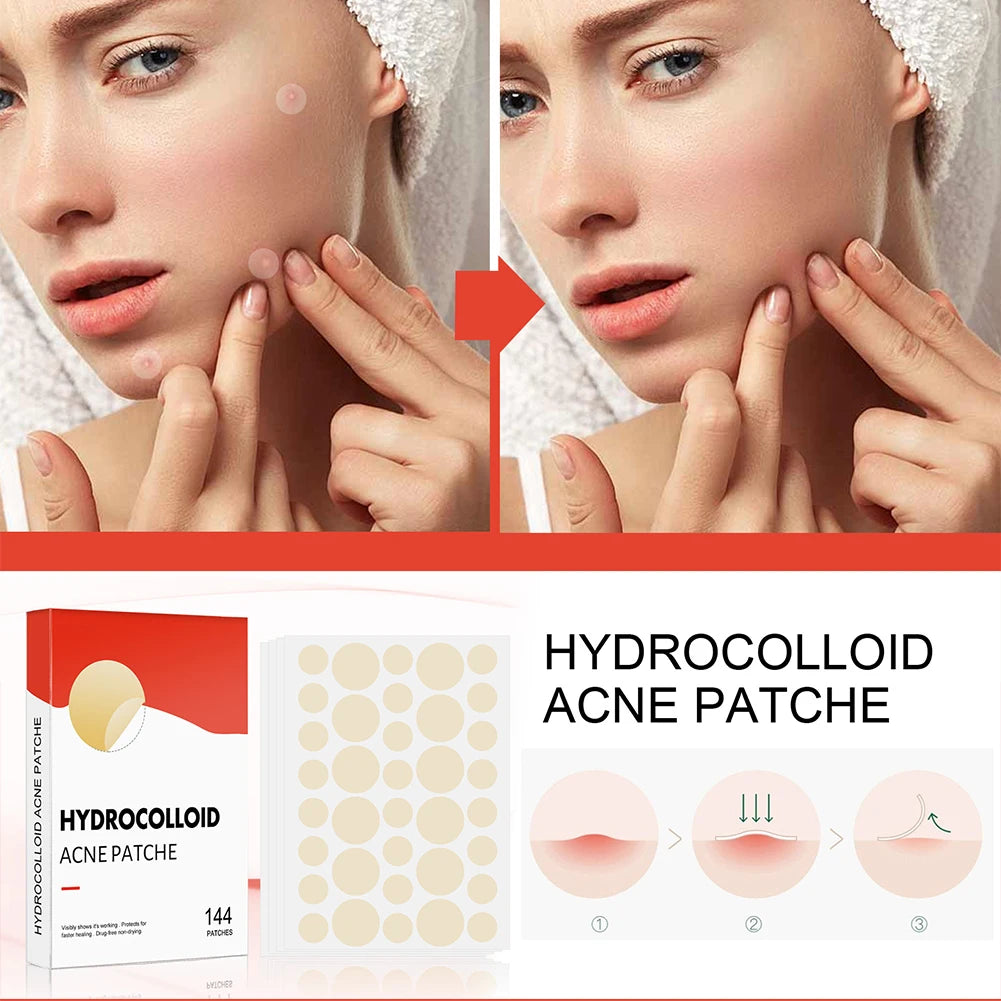Invisible Healing Acne Patch Set