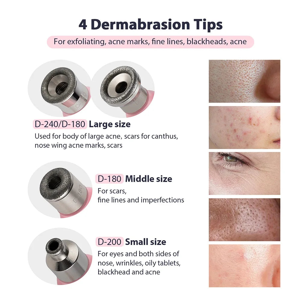Portable Diamond Microdermabrasion Peeling Machine