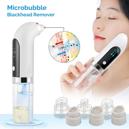 Microbubble Blackhead Remover Facial Vacuum Machine