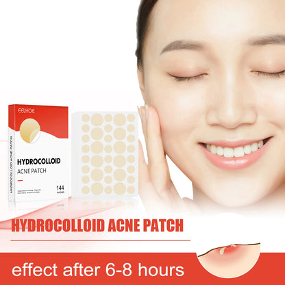 Invisible Hydrocolloid Acne Patches in Two Sizes