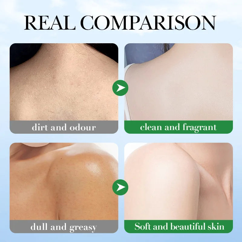 Peppermint Kojic Handmade Brightening Soap