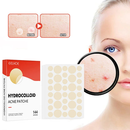 Invisible Healing Acne Patch Set