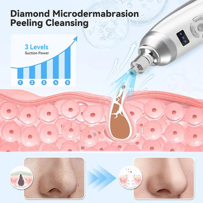 Upgraded Diamond Microdermabrasion Machine
