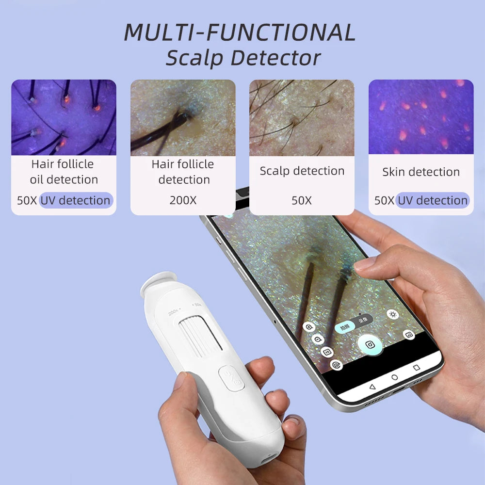 Wireless HD Scalp Analyzer Microscope