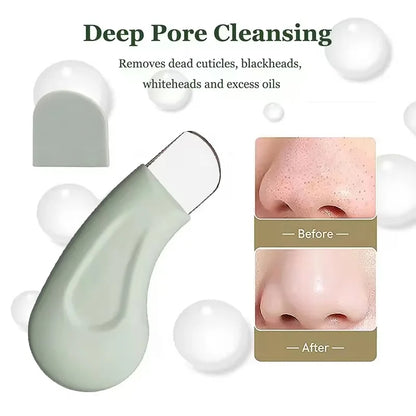 Nose and Face Blackhead Remover Tool
