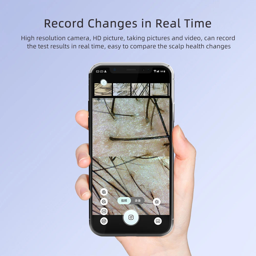 Wireless HD Scalp Analyzer Microscope