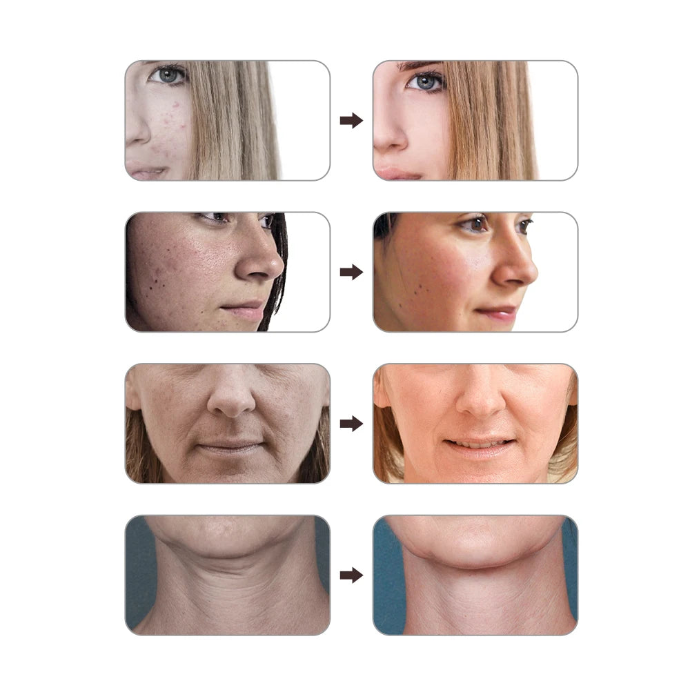 7-Color Silicone LED Therapy Mask