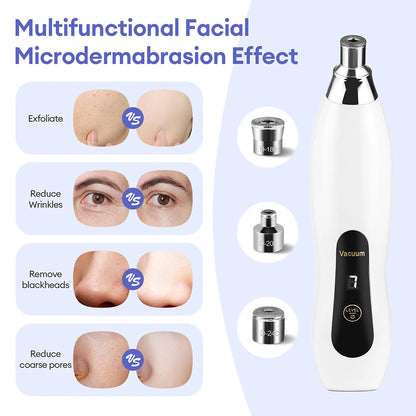 Diamond Microdermabrasion Facial Device