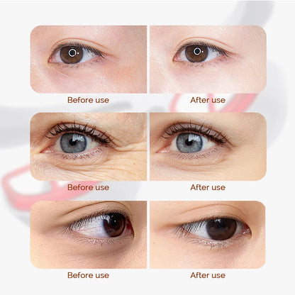 Wireless Red Light Eye Massager