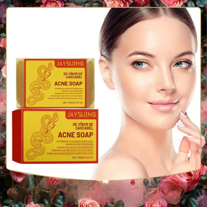 Acne-Control Cleansing Soap